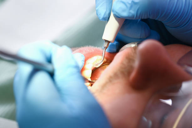 Best Emergency Orthodontic Services in Harbor Beach, MI